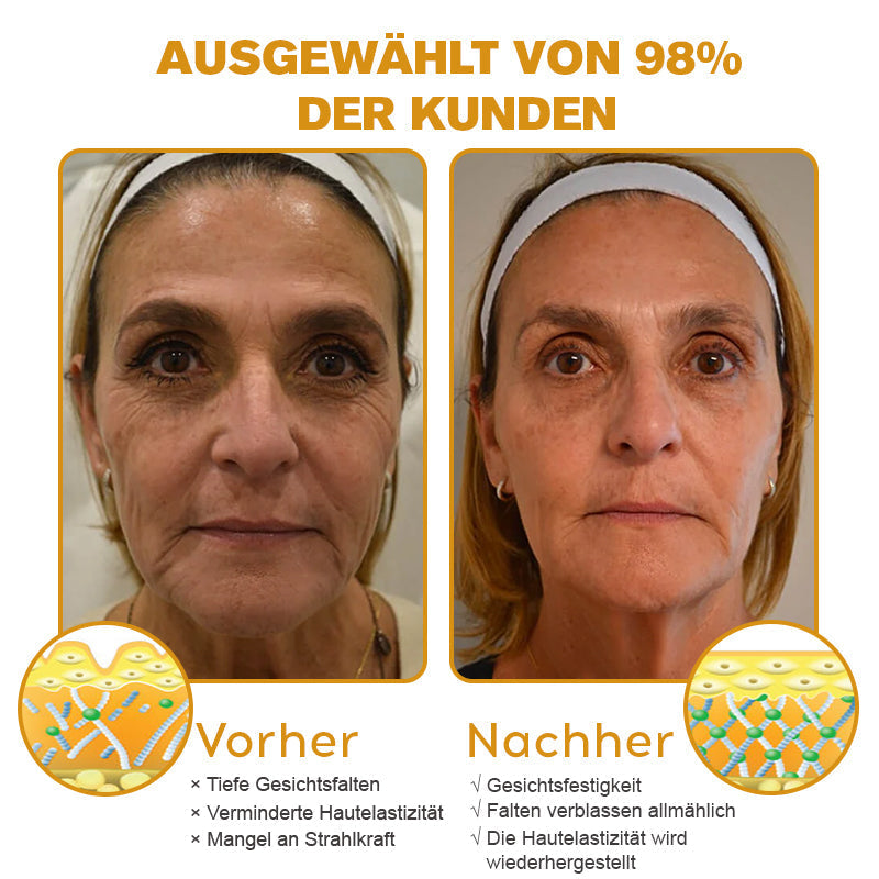 Furzero Botox™ Bienengift natürliches Botox und Faltenentferner 