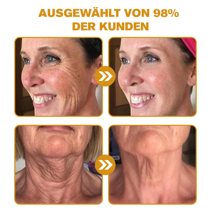 Furzero Botox™ Bienengift natürliches Botox und Faltenentferner 