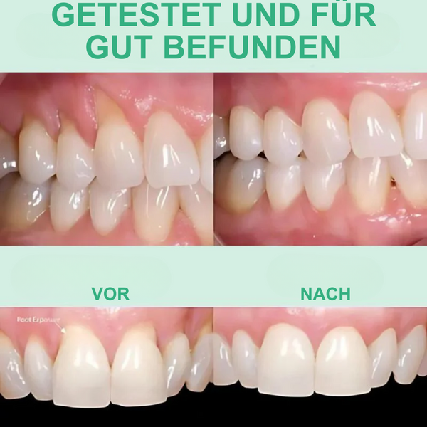 GumVital: Gesundes Zahnfleisch