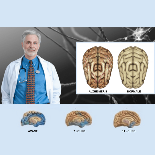 Demex™ | La formule de stimulation cérébrale restaure la mémoire dans 98% des cas en 14 jours !