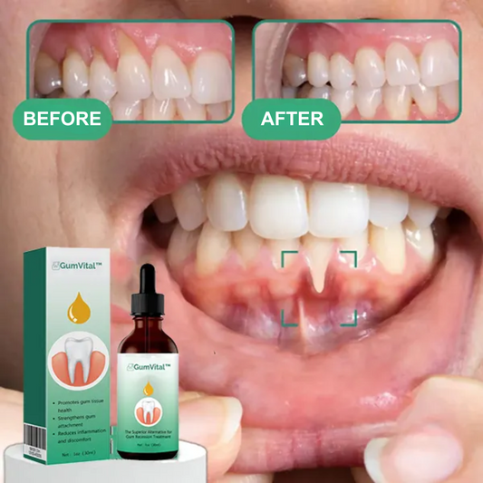 GumVital™ | Restores gum loosening in 93% of cases in 4 days!